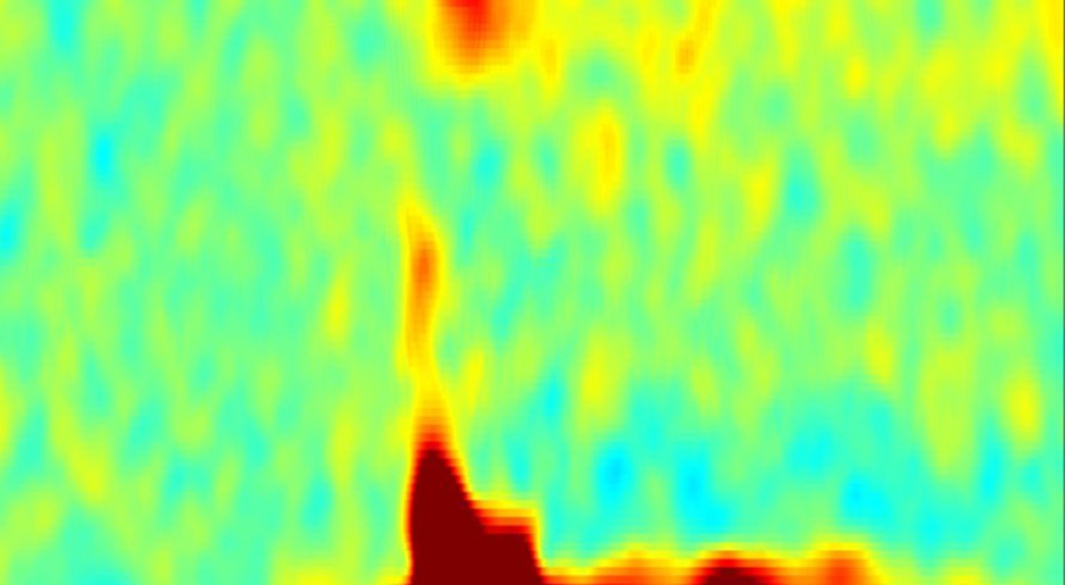 An example of a gamma oscillation 