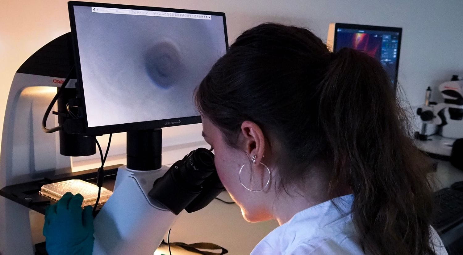A cancer cell being examined under a new high-powered microscope