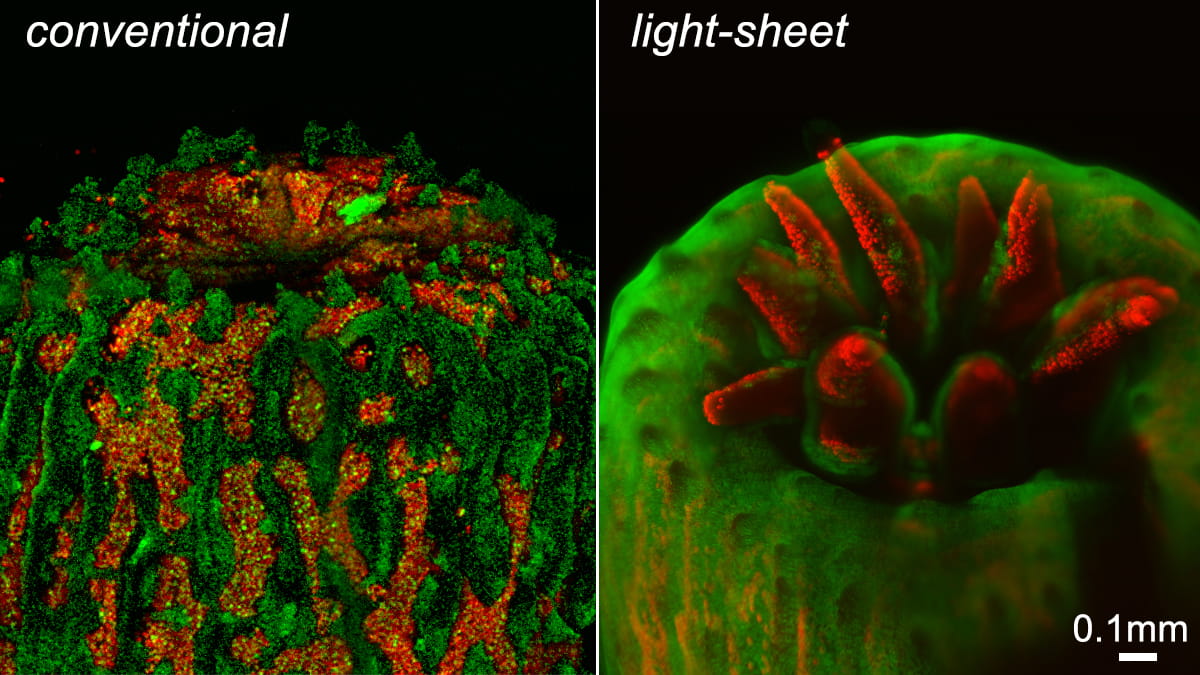 Left: Using a conventional microscope the polyp is fully retracted due to the intense light. Right: The polyp has fully emerged in the gentle illumination of a light-sheet fluorescence microscope developed at the University of Essex. The scalebar shows about a hair’s breadth.    First published in Nature Methods vol.14, 2017.)