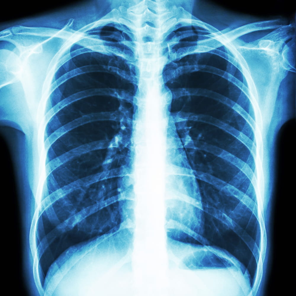 chest x-ray