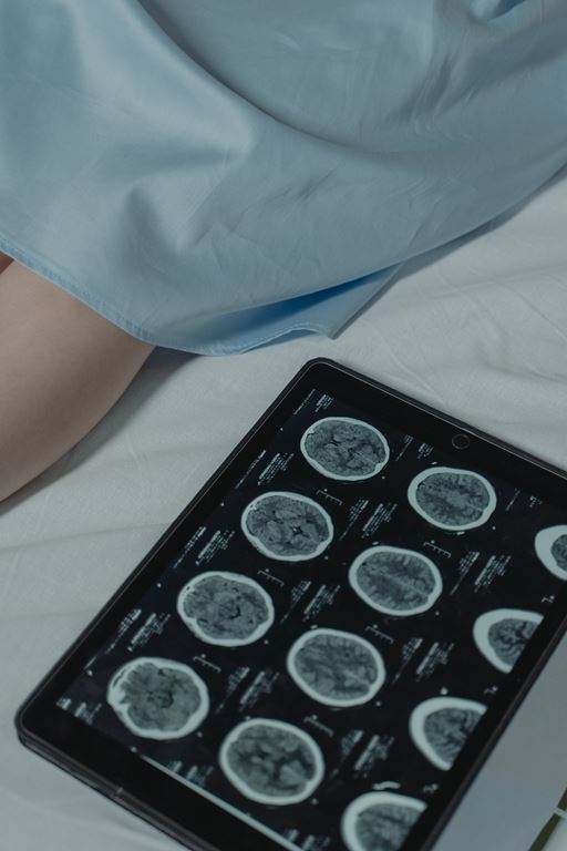 Brain scans on a tablet screen laying beside patient