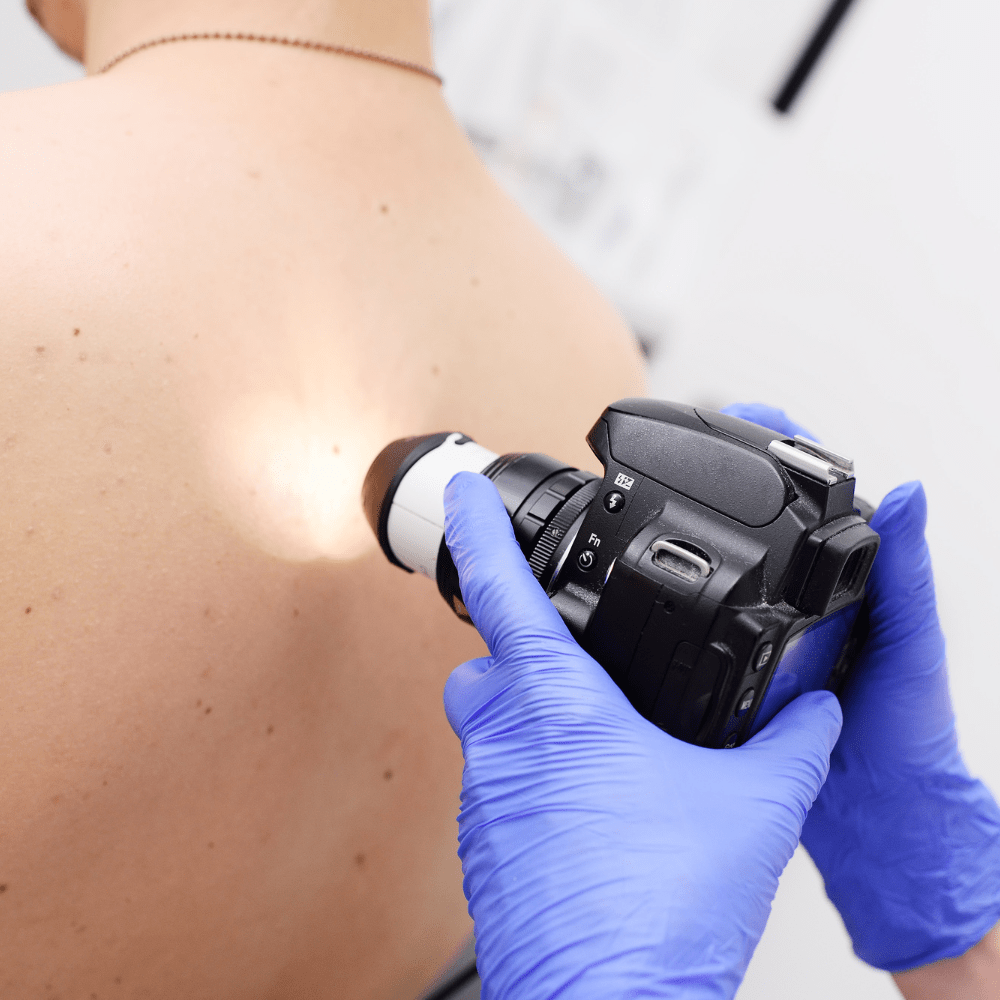 A test being carried out on a patient with suspected skin cancer