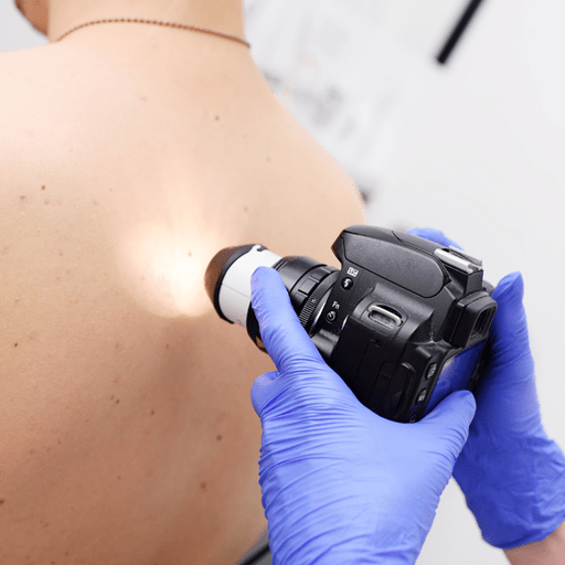 Skin Cancer Machine New AI model can detect 99% of skin cancer cases | University of Essex