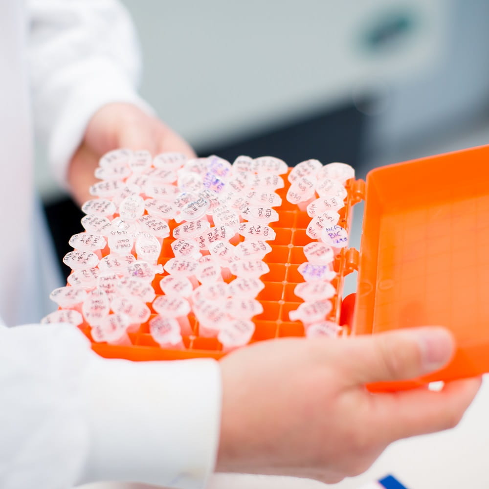 A person, mostly out of shot so just their hands and a white lab coat are visible, holding an orange box containing a collection of small tubes with lids.