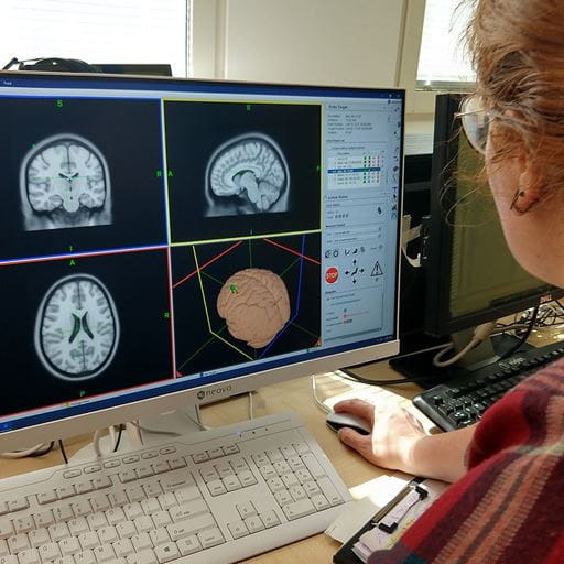 A person, mostly out of shot on the right hand side, is looking at a computer screen which shows four squares. Three contain black and white scans of a human brain and the fourth shows a 3D model of a brain.