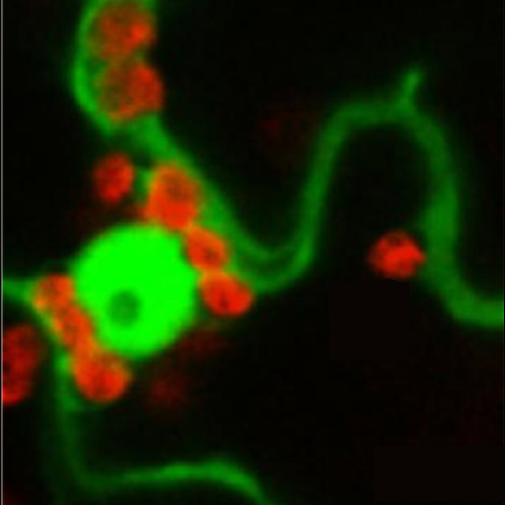 Chloroplasts associated with the nucleas
