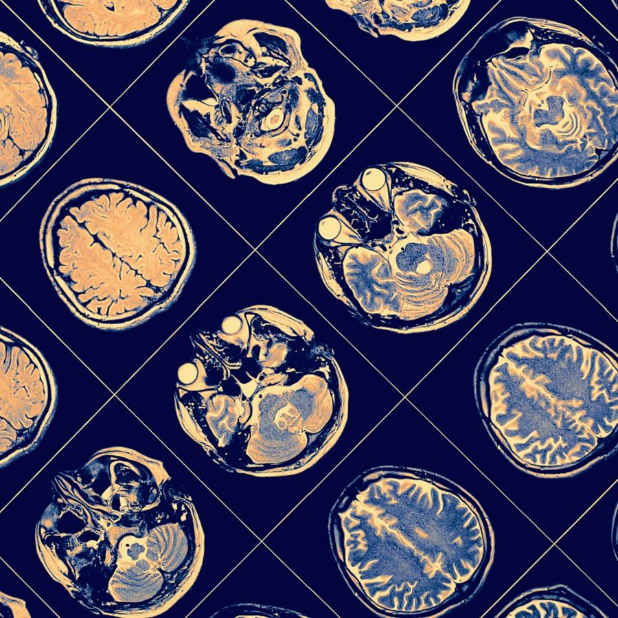 A practical introduction to neuropsychoanalysis: Clinical implications