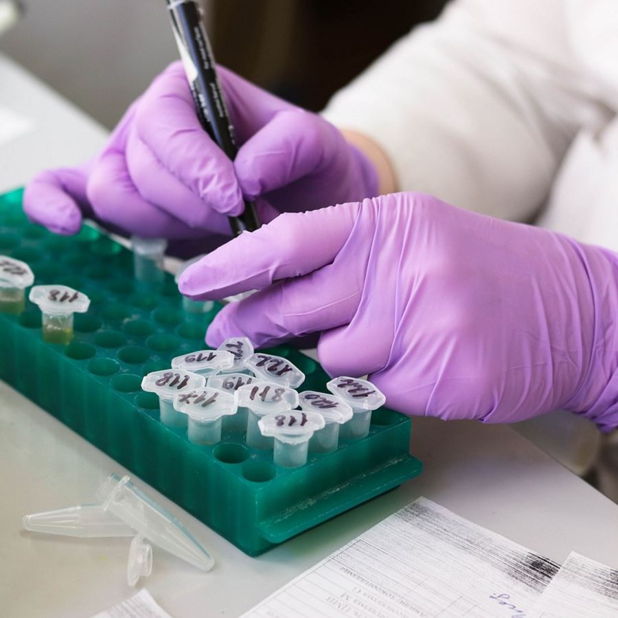 Why testing for COVID-19 is crucial