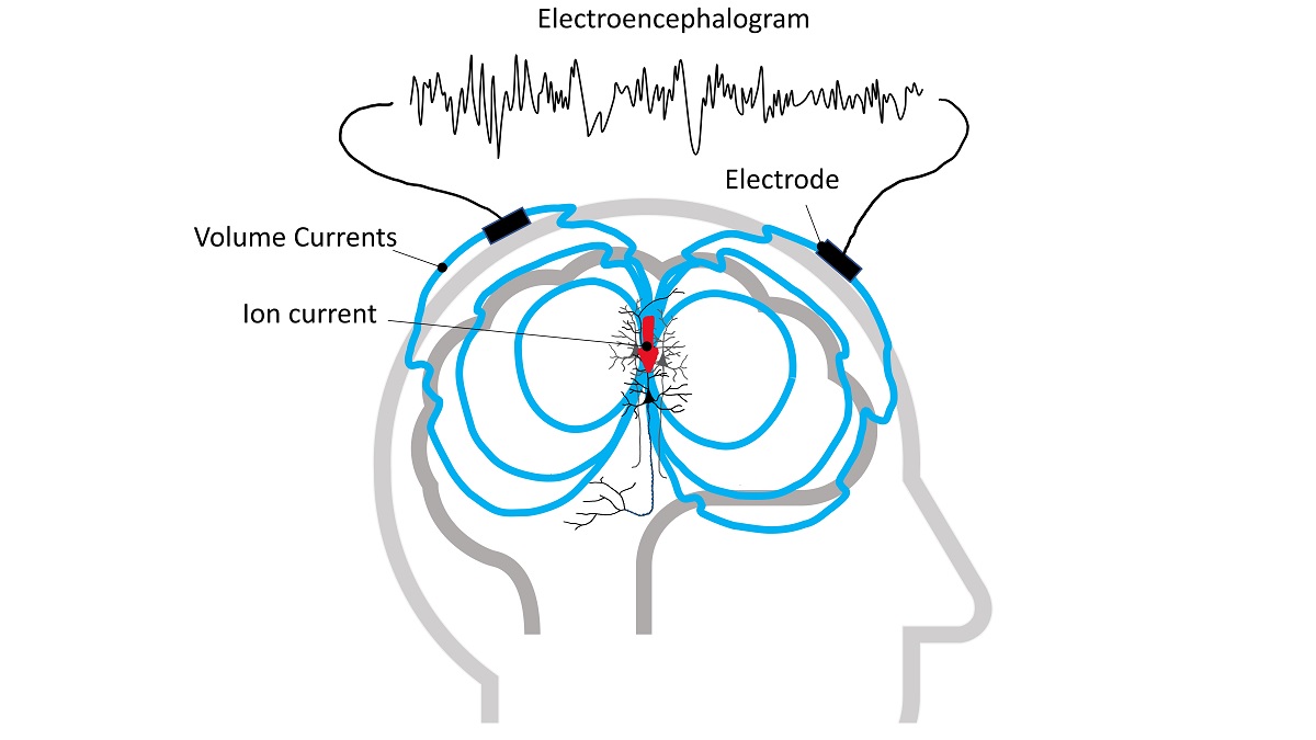 Sensors in the EEG cap record the currents and electrical signals. Understanding them is the key to neurotechnology.)